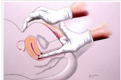 ����������� ������������: ��� ���������� ���� � �����