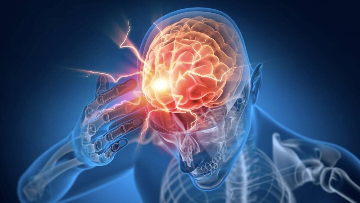 Эпилепсия: как распознать и лечить опасное заболевание