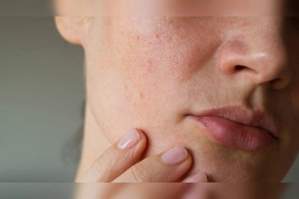 ��� ������ ���������� �� �������� ����: ������ �����